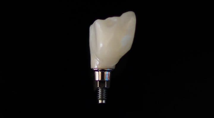 Close up of dental implant on black background