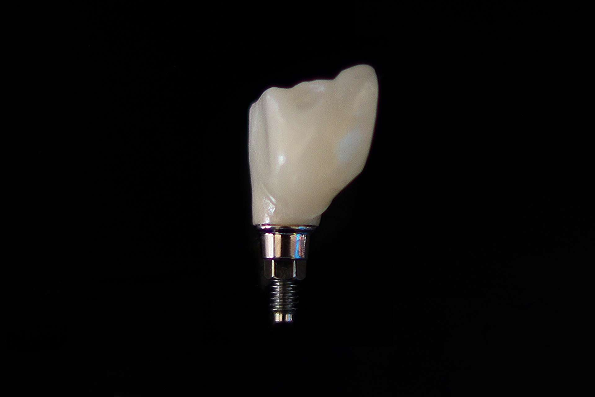 Close up of dental implant on black background