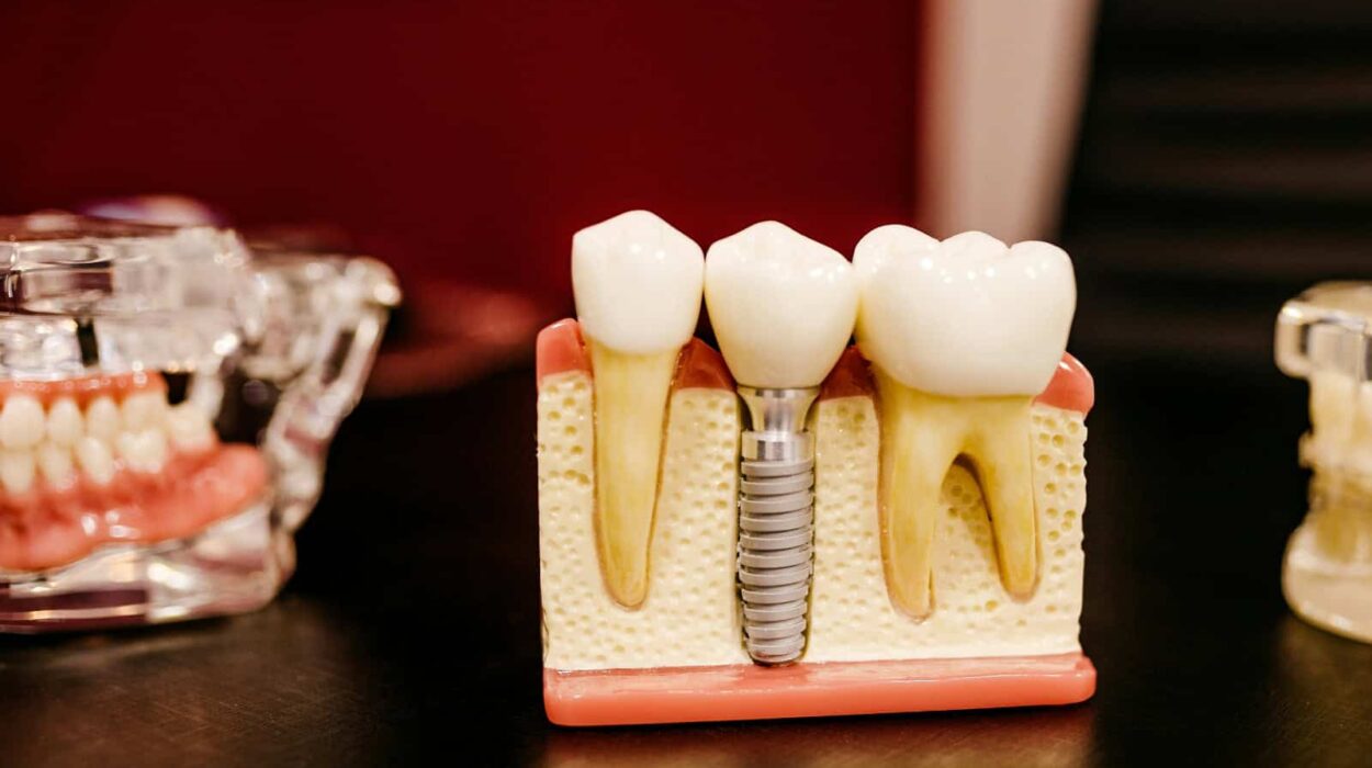dental implants mockup on dentists desk, next to 2 dentures models