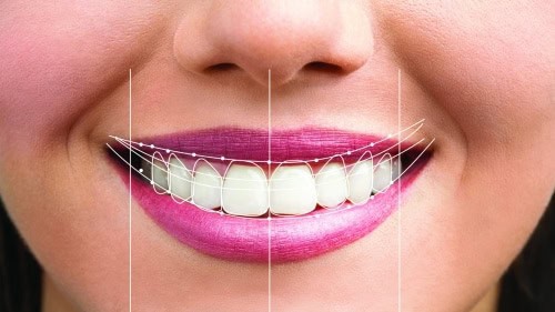 Woman's smile digitally designed