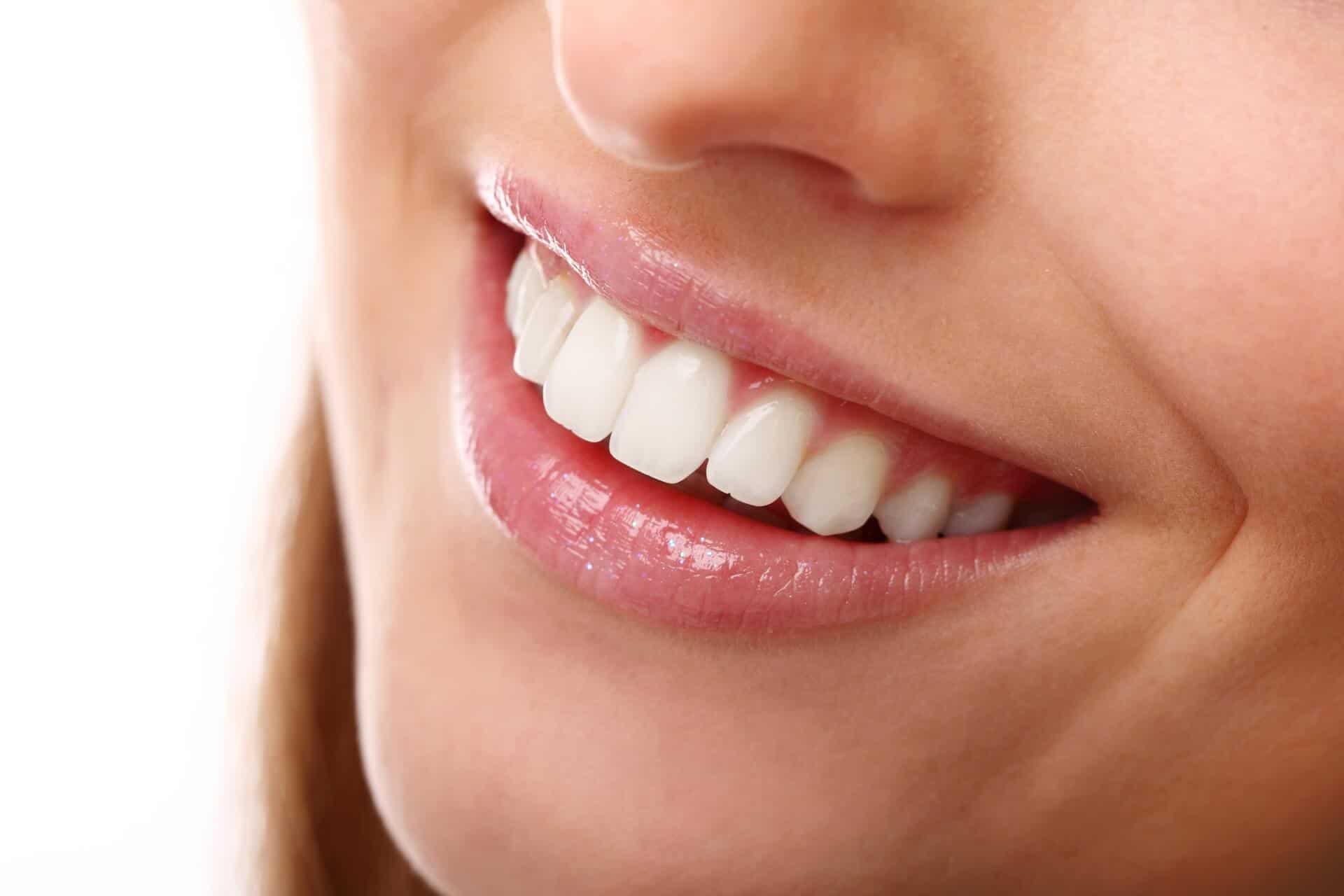 Closeup of woman smiling with clean white teeth