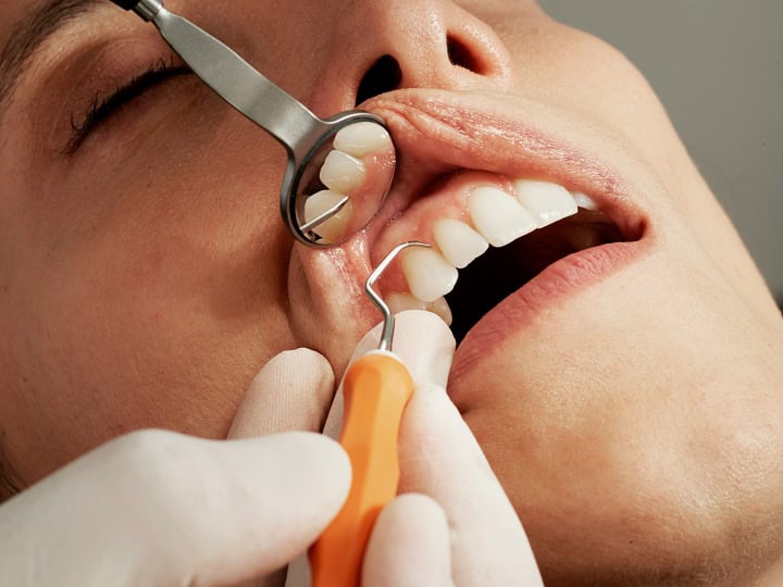 woman getting her teeth cleaned