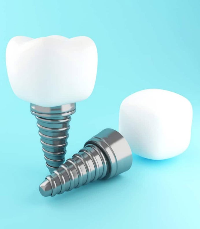 Dental Implants on blue background