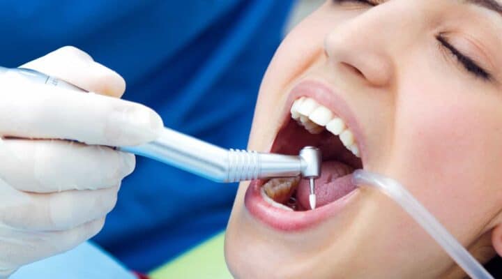 dental cleaning melbourne balwyn