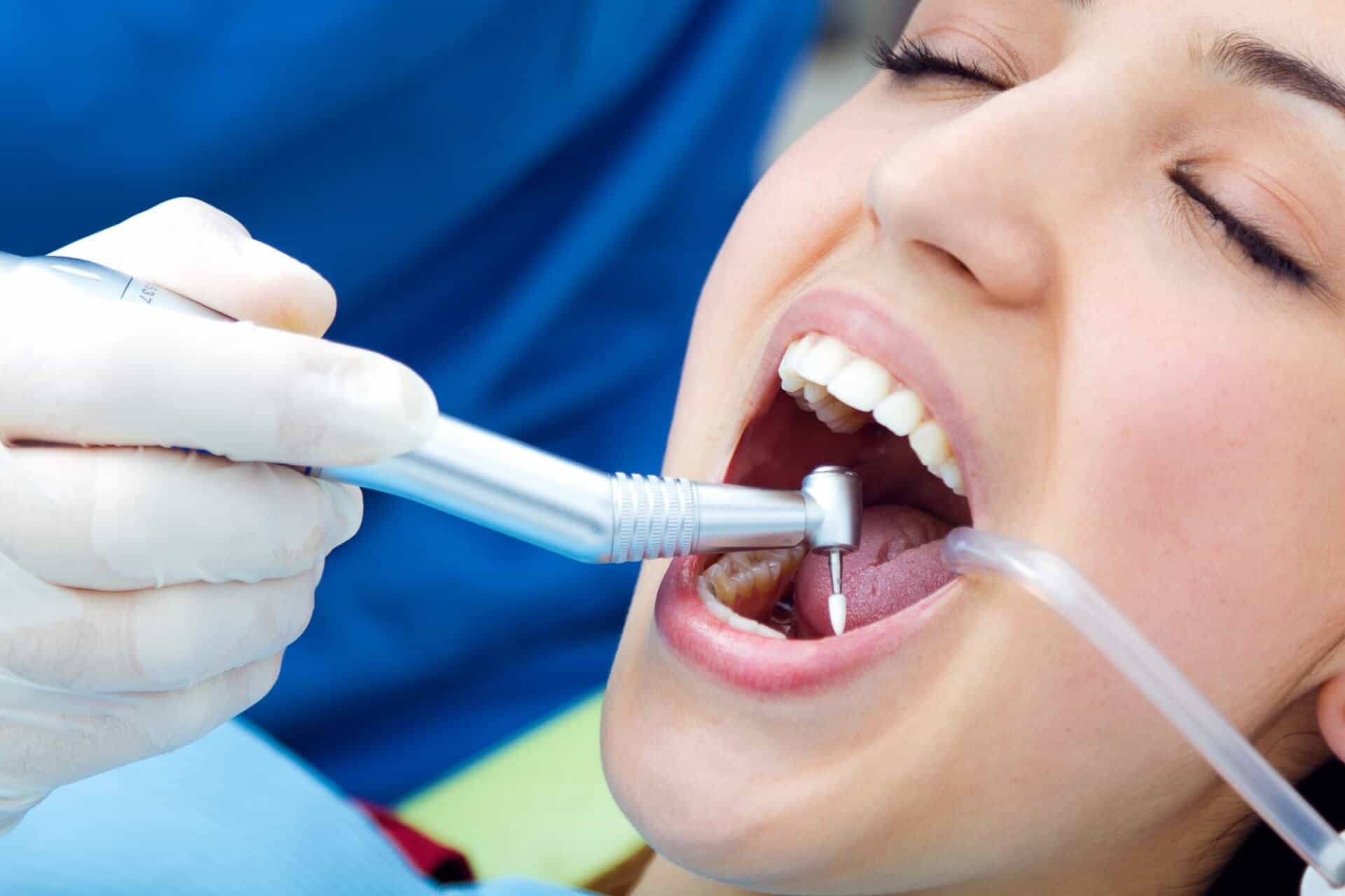dental cleaning melbourne balwyn