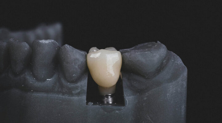 dental implant model in mockup jaw