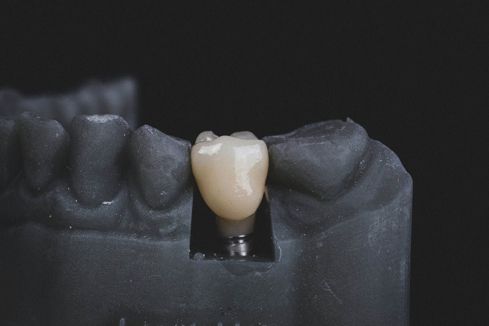dental implant model in mockup jaw
